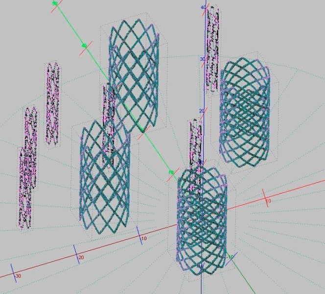 В Перми разработали технологию 3D-печати стентов для коронарных сосудов сердца