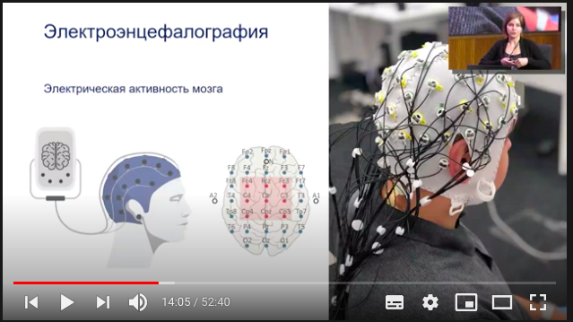 Вечно молодой: что происходит с мозгом со временем и как остановить его старение