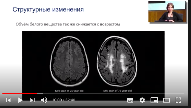 Вечно молодой: что происходит с мозгом со временем и как остановить его старение